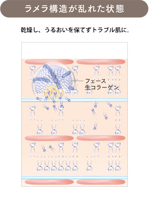 ラメラ構造が乱れた状態